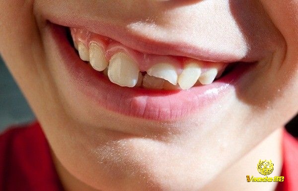 Nếu bạn mơ thấy mình nhổ răng cho người khác sẽ thể hiện cho sự quan tâm và lo lắng của mình với người đó