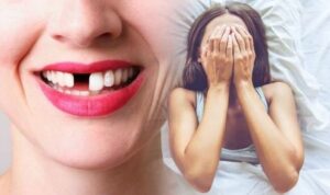 Giải mã giấc mơ thấy mình rụng răng và con số liên quan